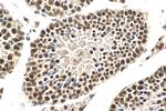 SAFB Antibody in Immunohistochemistry (Paraffin) (IHC (P))