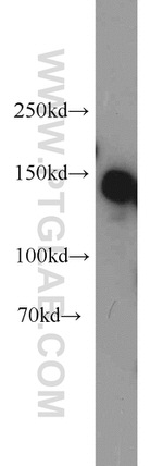 SAFB Antibody in Western Blot (WB)