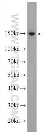 SAFB Antibody in Western Blot (WB)