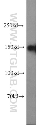 SAFB Antibody in Western Blot (WB)