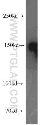 SAFB Antibody in Western Blot (WB)