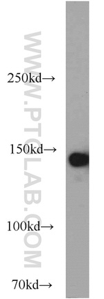 SAFB Antibody in Western Blot (WB)