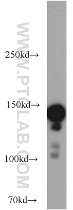 SAFB Antibody in Western Blot (WB)