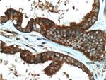 DOCK4 Antibody in Immunohistochemistry (Paraffin) (IHC (P))