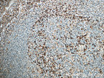 IL-6 Antibody in Immunohistochemistry (Paraffin) (IHC (P))