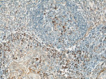 IL-6 Antibody in Immunohistochemistry (Paraffin) (IHC (P))