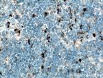 IL-6 Antibody in Immunohistochemistry (Paraffin) (IHC (P))