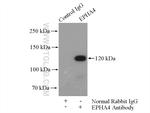 EPHA4 Antibody in Immunoprecipitation (IP)