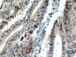 P53 Antibody in Immunohistochemistry (Paraffin) (IHC (P))