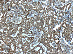 P53 Antibody in Immunohistochemistry (Paraffin) (IHC (P))