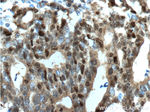 P53 Antibody in Immunohistochemistry (Paraffin) (IHC (P))