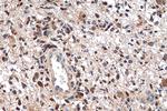 P53 Antibody in Immunohistochemistry (Paraffin) (IHC (P))