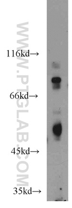 P53 Antibody in Western Blot (WB)