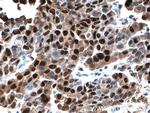 P53 Antibody in Immunohistochemistry (Paraffin) (IHC (P))