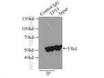 P53 Antibody in Immunoprecipitation (IP)