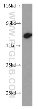 P53 Antibody in Western Blot (WB)