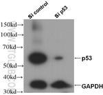 P53 Antibody in Western Blot (WB)