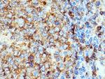 CD22 Antibody in Immunohistochemistry (Paraffin) (IHC (P))