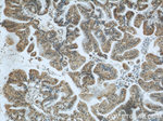 ZBTB38 Antibody in Immunohistochemistry (Paraffin) (IHC (P))