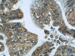 ZBTB38 Antibody in Immunohistochemistry (Paraffin) (IHC (P))