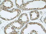 ZBTB38 Antibody in Immunohistochemistry (Paraffin) (IHC (P))