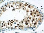 ZBTB38 Antibody in Immunohistochemistry (Paraffin) (IHC (P))