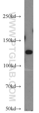 ZBTB38 Antibody in Western Blot (WB)