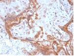 Fibroblast Activation Protein Alpha/FAP-1 Antibody in Immunohistochemistry (Paraffin) (IHC (P))