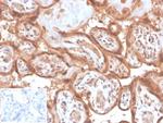 Fibroblast Activation Protein Alpha/FAP-1 Antibody in Immunohistochemistry (Paraffin) (IHC (P))