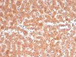 Fibroblast Activation Protein Alpha/FAP-1 Antibody in Immunohistochemistry (Paraffin) (IHC (P))