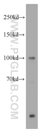 OAS3 Antibody in Western Blot (WB)