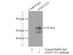 ONECUT2 Antibody in Immunoprecipitation (IP)