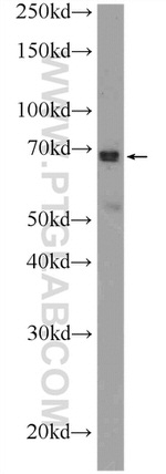 ONECUT2 Antibody in Western Blot (WB)