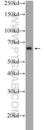 ONECUT2 Antibody in Western Blot (WB)