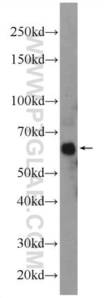 ONECUT2 Antibody in Western Blot (WB)