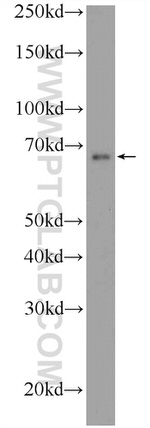 ONECUT2 Antibody in Western Blot (WB)