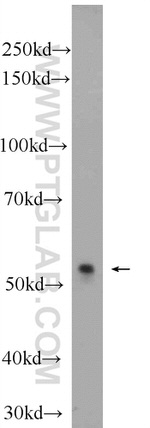 ONECUT2 Antibody in Western Blot (WB)