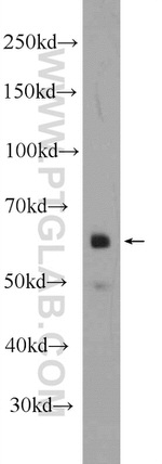 ONECUT2 Antibody in Western Blot (WB)