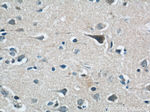 LGI3 Antibody in Immunohistochemistry (Paraffin) (IHC (P))