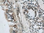 LGI3 Antibody in Immunohistochemistry (Paraffin) (IHC (P))