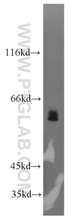 LGI3 Antibody in Western Blot (WB)