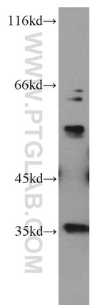 LGI3 Antibody in Western Blot (WB)