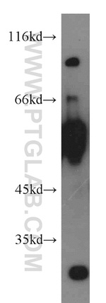 LGI3 Antibody in Western Blot (WB)