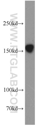 GRIN2B Antibody in Western Blot (WB)