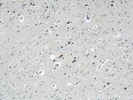 GRIN2B Antibody in Immunohistochemistry (Paraffin) (IHC (P))