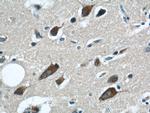 GRIN2B Antibody in Immunohistochemistry (Paraffin) (IHC (P))