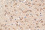 GRIN2B Antibody in Immunohistochemistry (Paraffin) (IHC (P))