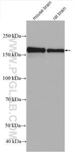 GRIN2B Antibody in Western Blot (WB)