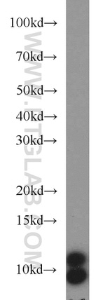 VMA21 Antibody in Western Blot (WB)