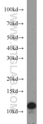 VMA21 Antibody in Western Blot (WB)